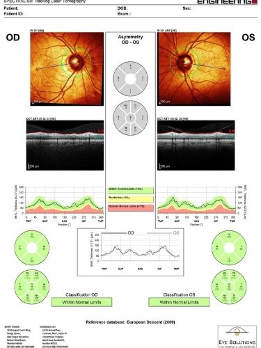 OCT glaucoma normal