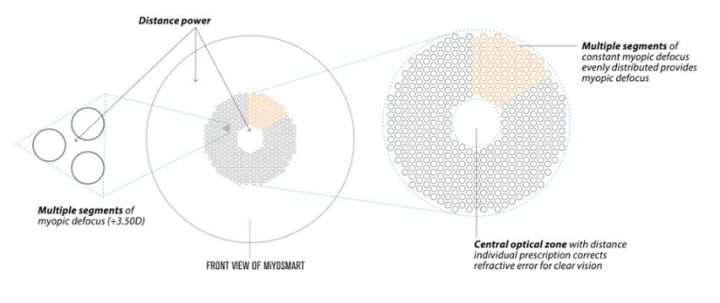 How miyosmart glasses are designed