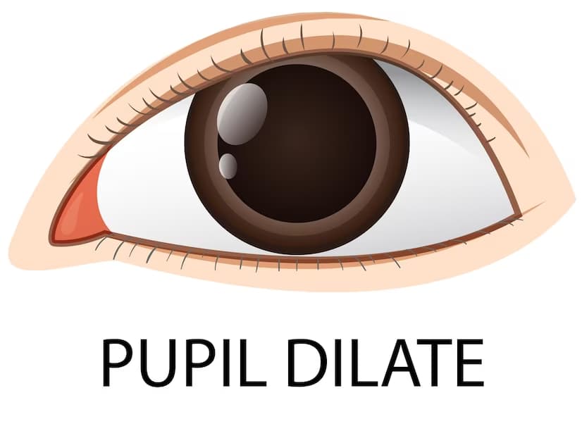 Understanding Mydriasis or Dilated Pupils